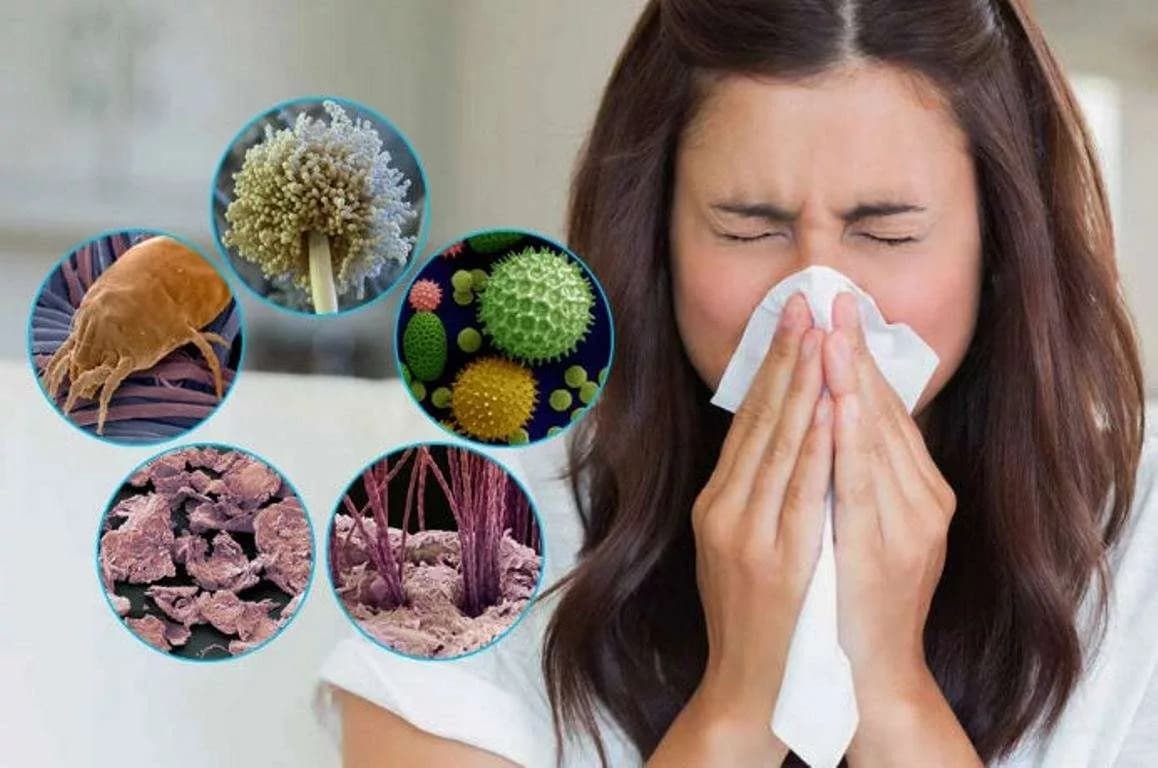 Allergiya
