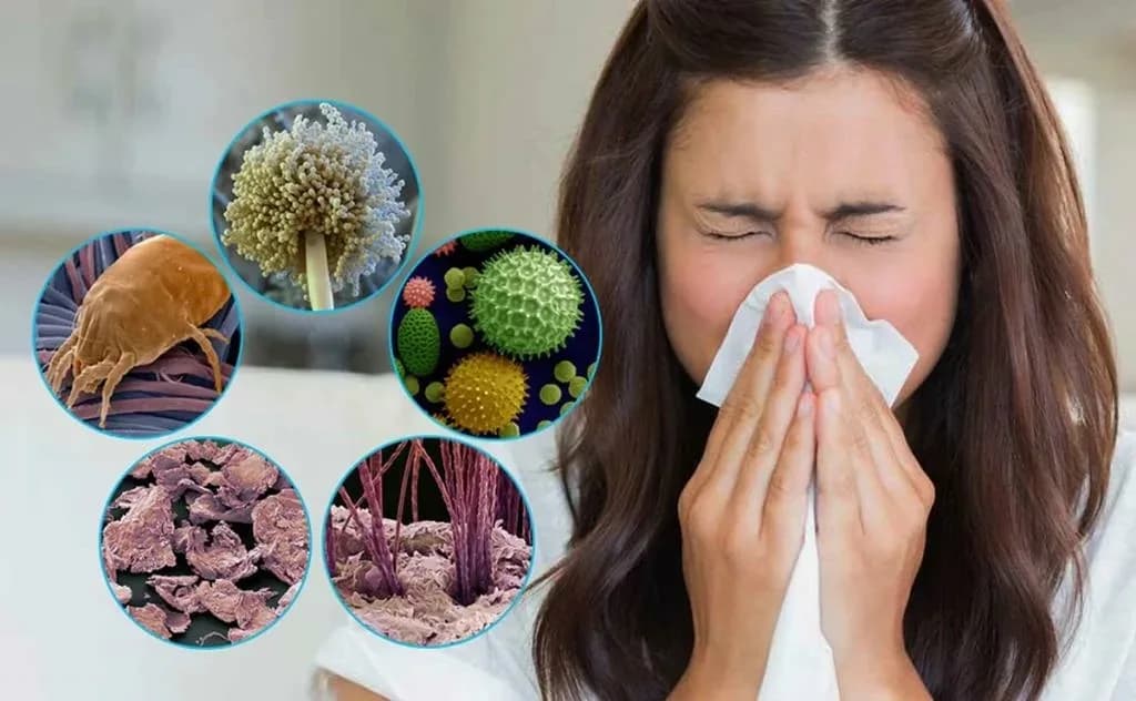 Allergiyaya qarşı mühüm olan 13 meyar