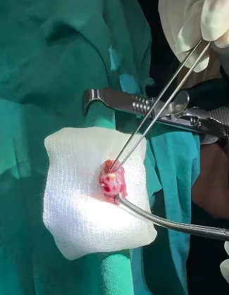 LOR cərrah Op. Dr. Jalə Eyvazova