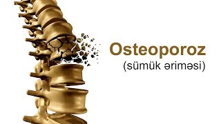 Osteoporoz